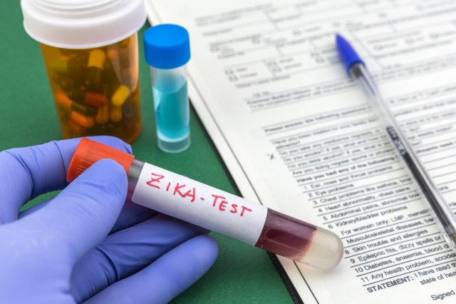 Zika virus stvara ozbiljne posledice za dve grupe pacijenata: Kako da ga prepoznate na vreme?